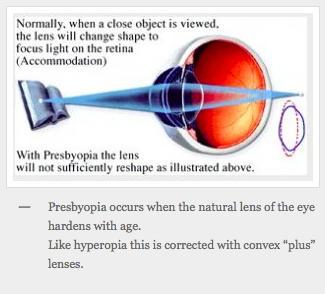 Presbyopia (Middle age reading difficulty)